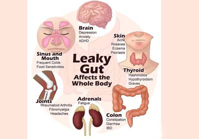 Bad Gut Health? Learn How Ayurveda Can Help You Deal With It?